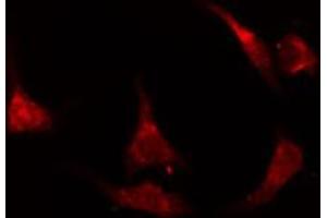 ABIN6274675 staining A549 cells by IF/ICC. (JNK2 抗体  (N-Term))