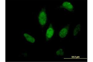 Immunofluorescence of purified MaxPab antibody to FKBP5 on HeLa cell. (FKBP5 抗体  (AA 1-457))