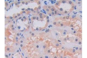 Immunohistochemistry (IHC) image for anti-Lysyl Oxidase-Like 2 (LOXL2) (AA 544-751) antibody (ABIN7438565)
