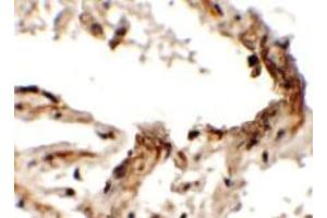 Immunohistochemistry of EMX2 in human lung tissue with EMX2 Antibody at 2.