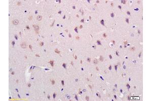 Formalin-fixed and paraffin embedded mouse brain labeled with Rabbit Anti Acylglycerol Kinase Polyclonal Antibody, Unconjugated (ABIN716741) at 1:200 followed by conjugation to the secondary antibody and DAB staining (Acylglycerol Kinase 抗体  (AA 335-422))
