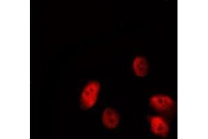 ABIN6277191 staining HepG2 by IF/ICC. (Histone 3 抗体  (N-Term))