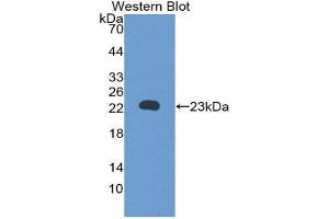 Western Blotting (WB) image for anti-Retinol Binding Protein 5, Cellular (RBP5) (AA 19-201) antibody (ABIN1860415) (Retinol Binding Protein 5 抗体  (AA 19-201))