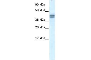WB Suggested Anti-SAP30BP Antibody Titration:  0.