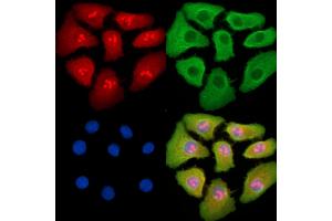 ABIN7095388 and ABIN7099445 staining Hela cells by IF/ICC. (PREX2 抗体)