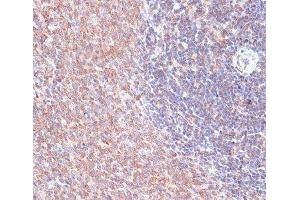Immunohistochemistry of paraffin-embedded Rat spleen using TMX1 Polyclonal Antibody at dilution of 1:100 (40x lens).