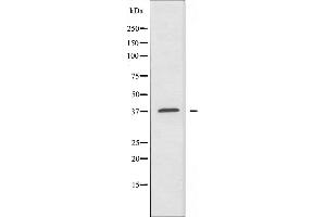 Western blot analysis of extracts from K562 cells, using A4GNT antibody. (A4GNT 抗体  (C-Term))