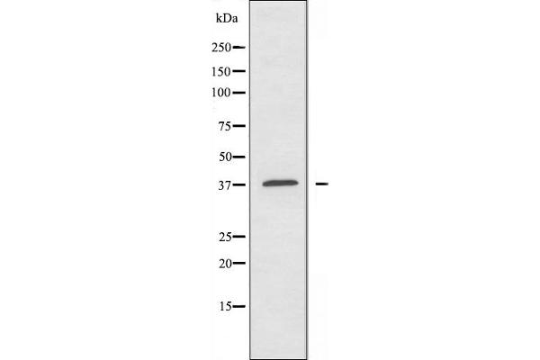 A4GNT antibody  (C-Term)