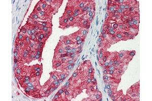 Anti-MUC13 antibody IHC of human prostate. (MUC13 抗体  (Internal Region))