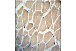 Immunohistochemistry analysis in formalin fixed and paraffin embedded human skeletal muscle reacted with KLHDC1 Antibody (N-term) followed which was peroxidase conjugated to the secondary antibody and followed by DAB staining. (KLHDC1 抗体  (N-Term))