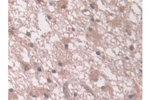 Immunohistochemistry (IHC) image for anti-Aminoadipate Semialdehyde Synthase (AASS) (AA 33-455) antibody (ABIN7444178)