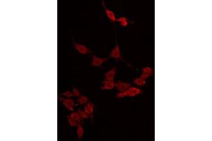 ABIN6274858 staining LOVO by IF/ICC. (Apolipoprotein L 4 抗体)