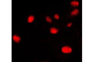 Immunofluorescent analysis of Ku70 staining in HeLa cells. (XRCC6 抗体  (C-Term))