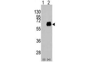 Image no. 1 for anti-Myc Proto-Oncogene protein (MYC) antibody (ABIN357365)