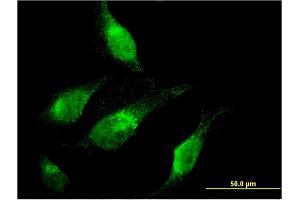 Immunofluorescence of monoclonal antibody to CHD1 on HeLa cell. (CHD1 抗体  (AA 1177-1272))