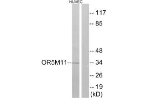 Western blot analysis of extracts from HUVEC cells, using OR5M11 antibody. (OR5M11 抗体  (C-Term))