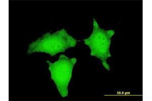 Immunofluorescence of monoclonal antibody to CTNNB1 on HeLa cell. (CTNNB1 抗体  (AA 682-781))