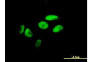 Immunofluorescence of purified MaxPab antibody to ZNF187 on HeLa cell. (ZNF187 抗体  (AA 1-325))