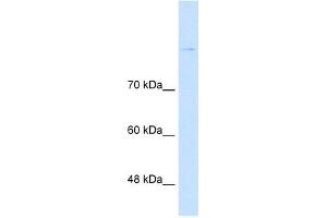 CDH8 antibody used at 1 ug/ml to detect target protein. (Cadherin 8 抗体  (Middle Region))