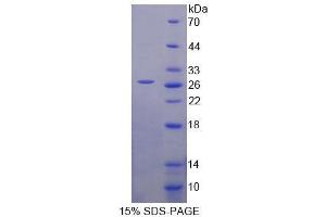 SDS-PAGE analysis of Human HSPA12B Protein. (HSPA12B 蛋白)
