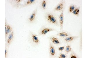 Immunohistochemistry (IHC) image for anti-ATP Synthase, H+ Transporting, Mitochondrial Fo Complex, Subunit D (ATP5H) (AA 2-161) antibody (ABIN3043795)