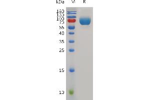 SDS-PAGE (SDS) image for CD226 (CD226) (AA 19-254) protein (Fc Tag) (ABIN7491035)