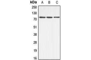 Western Blotting (WB) image for anti-ATP-Binding Cassette, Sub-Family B (MDR/TAP), Member 10 (ABCB10) (Center) antibody (ABIN7297968)