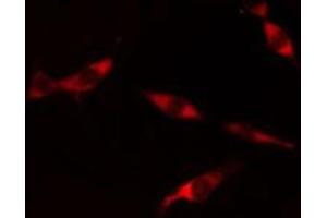 ABIN6275716 staining  Hela cells by IF/ICC.