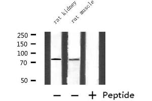 Western blot analysis of extracts from rat kidney and rat muscle, using CEACAM5 Antibody. (CEACAM5 抗体  (Internal Region))