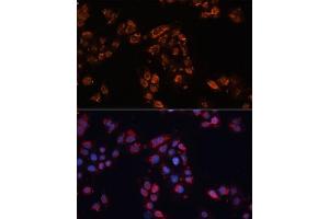 Immunofluorescence analysis of HeLa cells using  antibody (ABIN6129850, ABIN6136348, ABIN6136349 and ABIN6224537) at dilution of 1:100. (ABCB11 抗体  (AA 600-750))