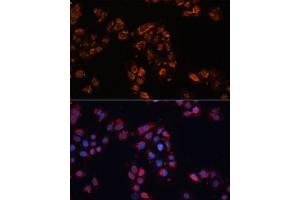 Immunofluorescence (IF) image for anti-ATP-Binding Cassette, Sub-Family B (MDR/TAP), Member 11 (ABCB11) (AA 600-750) antibody (ABIN6136348)