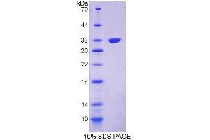 SDS-PAGE analysis of Mouse PPP1R15A Protein. (Protein phosphatase 1 (Regulatory Subunit 15A) 蛋白)