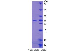 SDS-PAGE analysis of Mouse CISH Protein. (CISH 蛋白)