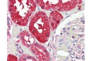 IHC-P Image Aminoacylase 1 antibody [N2C3-2] detects Aminoacylase-1 protein at cytoplasm on human placenta by immunohistochemical analysis. (Aminoacylase 1 抗体)