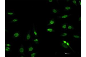 Immunofluorescence of purified MaxPab antibody to RFX2 on HeLa cell. (RFX2 抗体  (AA 1-723))