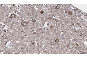 ABIN6277226 at 1/100 staining Human brain cancer tissue by IHC-P. (RIPK2 抗体  (N-Term))