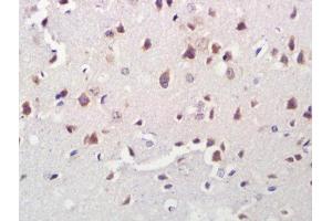 Formalin-fixed and paraffin embedded rat brain labeled with Anti-A2LD1/GGACT Polyclonal Antibody, Unconjugated (ABIN1387486) at 1:300 followed by conjugation to the secondary antibody and DAB staining. (GGACT 抗体  (AA 1-50))