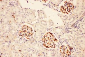 Anti-ACTH Picoband antibody,  IHC(P): Rat Kidney Tissue (POMC 抗体  (Middle Region))