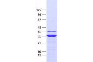 NADK2 Protein (His tag)