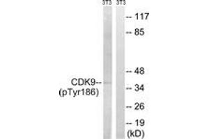 Western blot analysis of extracts from NIH-3T3 cells treated with Forskolin 40nM 30', using CDK9 (Phospho-Thr186) Antibody. (CDK9 抗体  (pThr186))