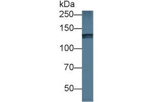Western blot analysis of Human HeLa cell lysate, using Mouse NIN Antibody (1 µg/ml) and HRP-conjugated Goat Anti-Rabbit antibody ( (Ninein 抗体  (AA 1-153))