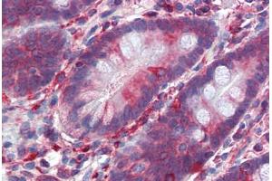 Human Small Intestine (formalin-fixed, paraffin-embedded) stained with SCML1 antibody ABIN462201 followed by biotinylated goat anti-rabbit IgG secondary antibody ABIN481713, alkaline phosphatase-streptavidin and chromogen. (SCML1 抗体  (AA 108-157))