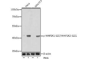 Western blot analysis of extracts of various cell lines, using Phospho-MK1-S217/MK2-S221 antibody (ABIN3019811, ABIN3019812, ABIN3019813, ABIN1681751 and ABIN1681752) at dilution. (MEK1 抗体  (pSer221, Ser217, Ser221))