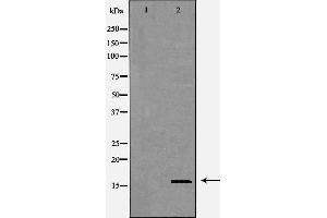 Western blot analysis of HEK293 cell lysate, using CST8 Antibody. (CST8 抗体  (Internal Region))