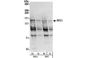 Western Blotting (WB) image for anti-Replication Factor C (Activator 1) 1, 145kDa (RFC1) (C-Term) antibody (ABIN7450653)
