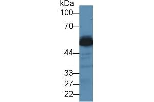 Western Blotting (WB) image for anti-Alanine Aminotransferase (ALT) (AA 147-263) antibody (ABIN7438472)