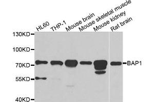 Western blot analysis of extracts of various cell lines, using BAP1 antibody.