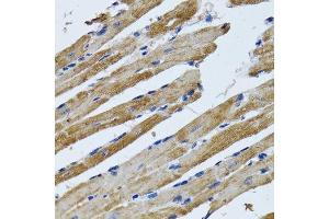 Immunohistochemistry (Paraffin-embedded Sections) (IHC (p)) image for anti-ATP Synthase, H+ Transporting, Mitochondrial F1 Complex, beta Polypeptide (ATP5B) (AA 230-529) antibody (ABIN6137326)
