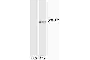Western blot analysis of PARP (cleavage site-specific). (PARP1 抗体  (Asp214, cleaved))