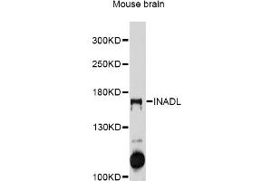 Western blot analysis of extracts of mouse brain, using INADL antibody (ABIN5997988) at 1/1000 dilution. (PATJ 抗体)